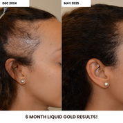 Liquid Gold (Hair Growth Oil)